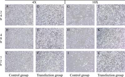 NK4 Regulates Laryngeal Squamous Cell Carcinoma Cell Properties and Inhibits Tumorigenicity by Modulating the DKK1/Wnt/β-Catenin Axis